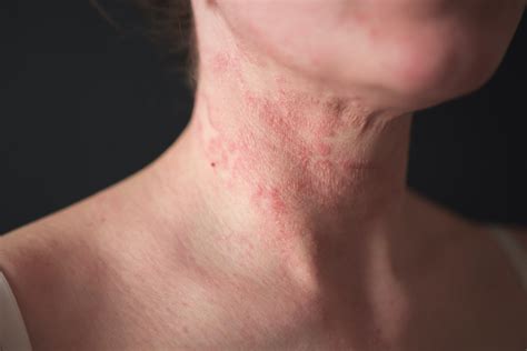 Nociceptors sense information about your environment, such as temperature, pressure, and conditions that could cause you harm at the cutaneous (<b>skin</b>) level. . Sharp pain on skin but nothing there